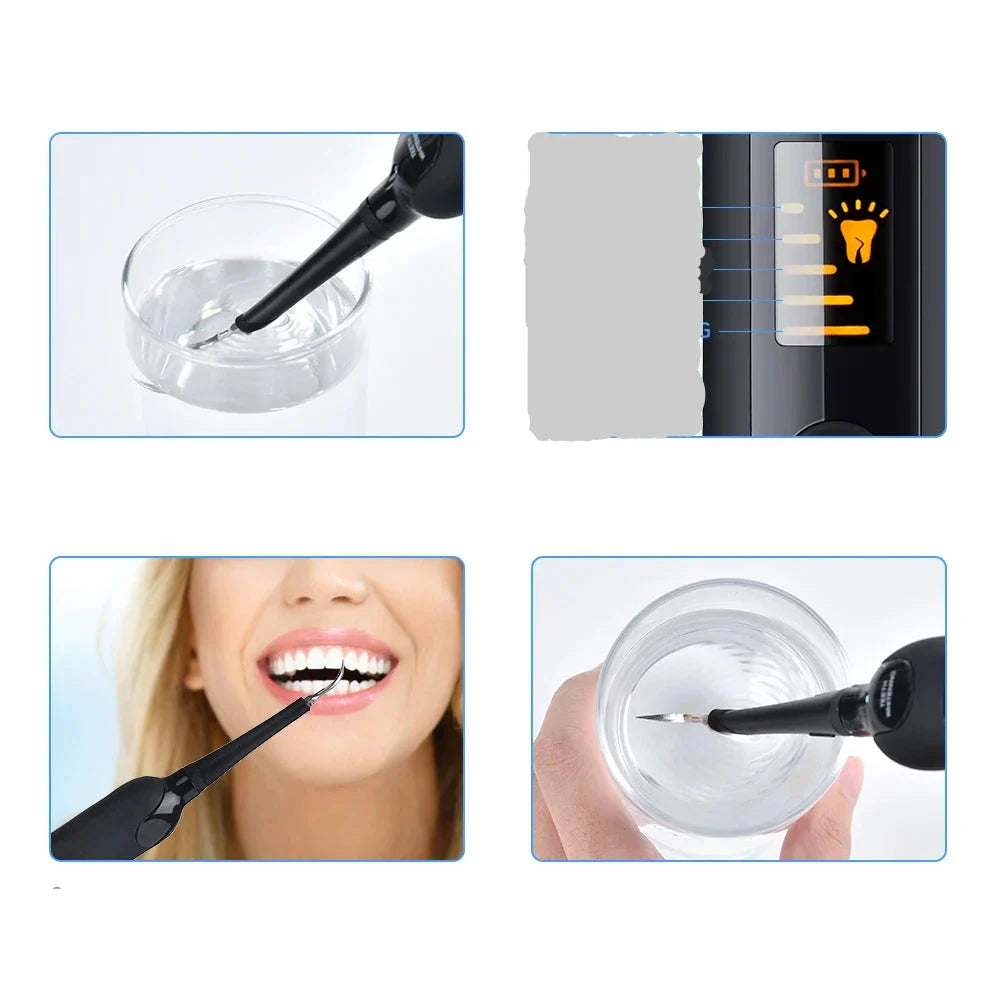 Electric Dental Cleaner Dentavibe 6-Stage | Teeth Whitening & Tartar Remover | Waterproof IPX6 | 21.5 cm