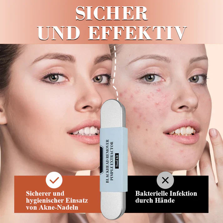 Blackhead Remover Set PureSkinX | Precise & Hygienic | Stainless Steel Tools for Clear Skin