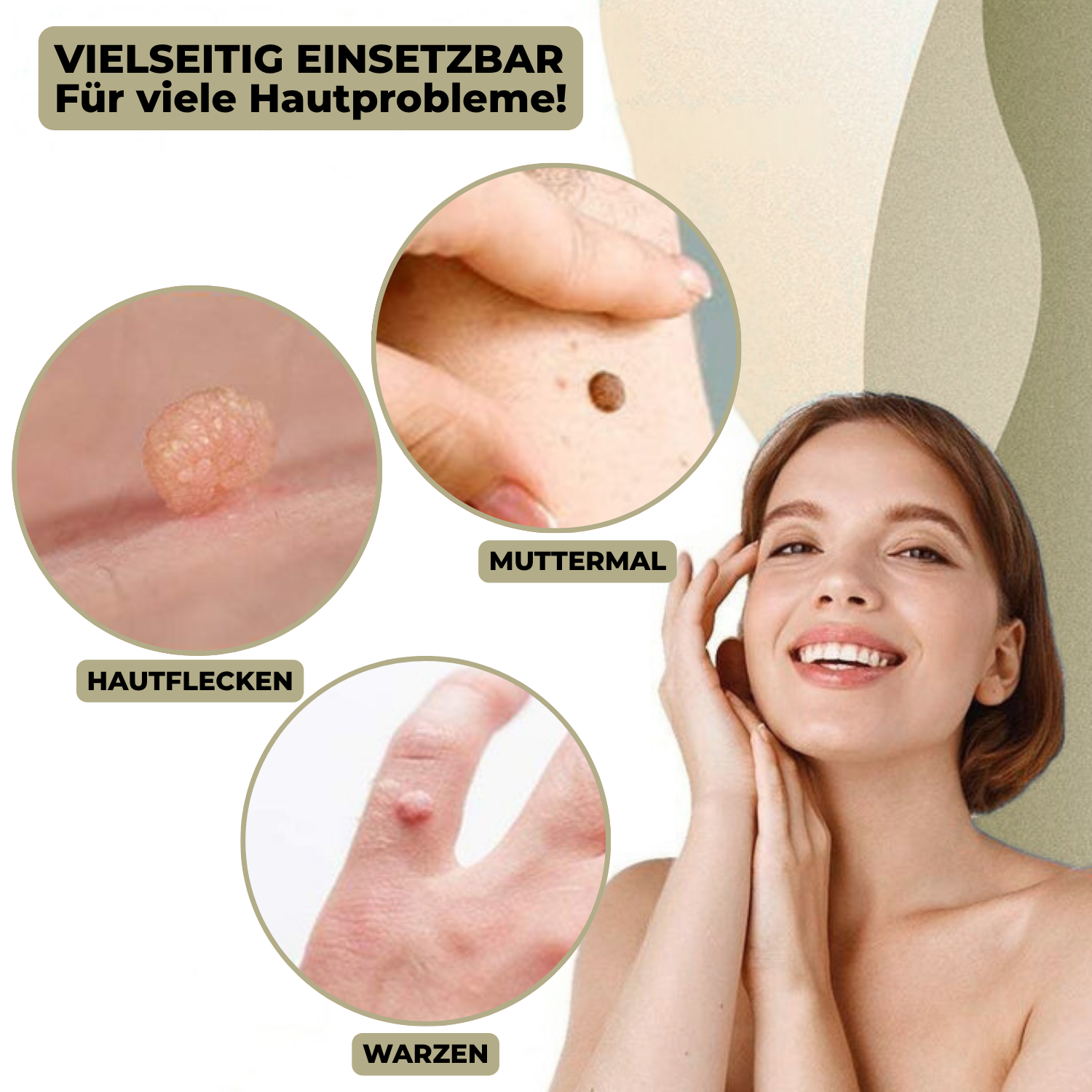DermaLinx Wart Remover | Pain-Free Removal of Warts & Moles | For Home Use | No Surgery
