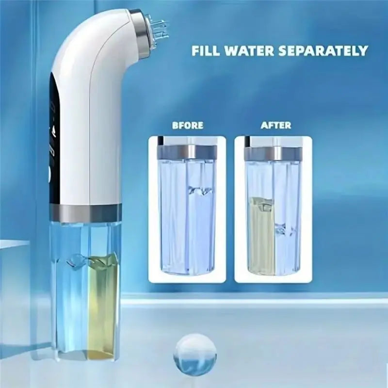 DermaFlow Mitesserentferner Elektrisch | Wasserpeeling & Vakuum | 3 Saugstärken | USB Wiederaufladbar