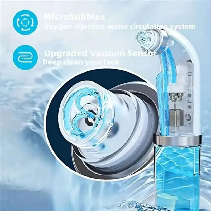 DermaFlow Mitesserentferner Elektrisch | Wasserpeeling & Vakuum | 3 Saugstärken | USB Wiederaufladbar