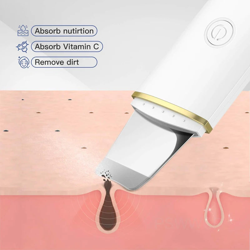 Dermalisse | Ultraschall Gesichtsreiniger | Porenreiniger & Hautpflegegerät | Tiefenreinigung mit USB-Aufladung