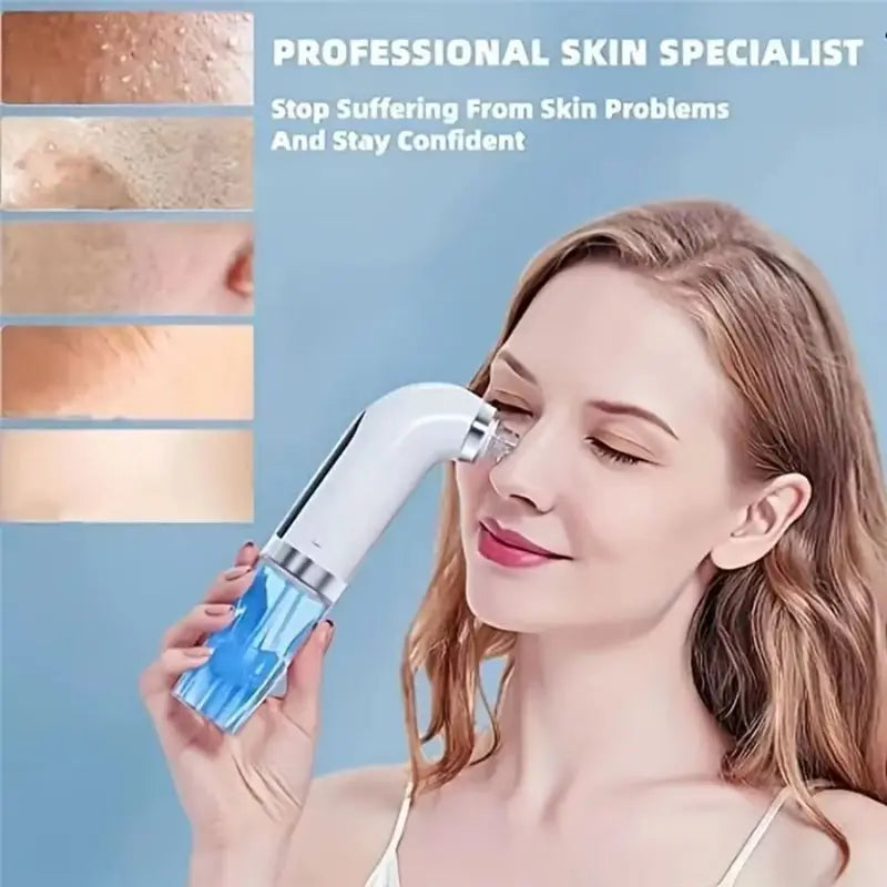 DermaFlow Mitesserentferner Elektrisch | Wasserpeeling & Vakuum | 3 Saugstärken | USB Wiederaufladbar