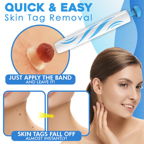 DermaClear Skin Tag Remover | Pain-Free Application | Compact & Hygienic | For Men & Women