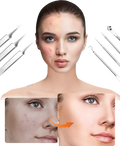 Blackhead Remover Set PureSkinX | Precise & Hygienic | Stainless Steel Tools for Clear Skin