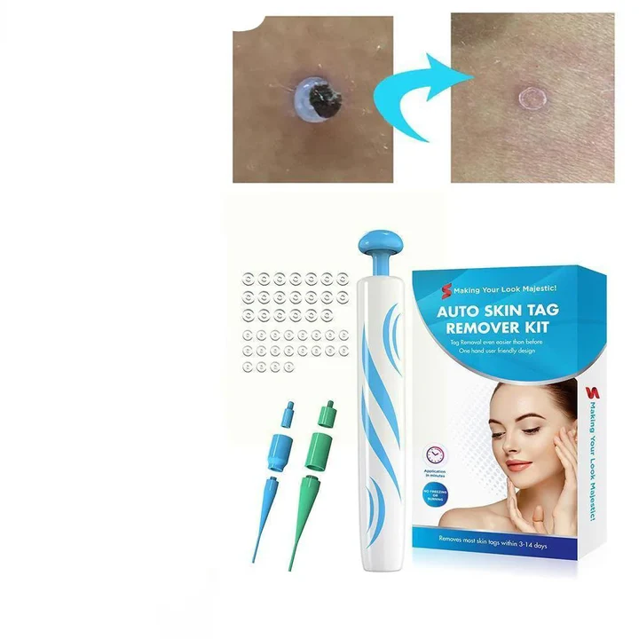 DermaClear Skin Tag Remover | Pain-Free Application | Compact & Hygienic | For Men & Women