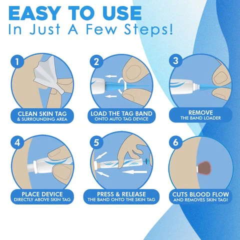 DermaClear Skin Tag Remover | Pain-Free Application | Compact & Hygienic | For Men & Women
